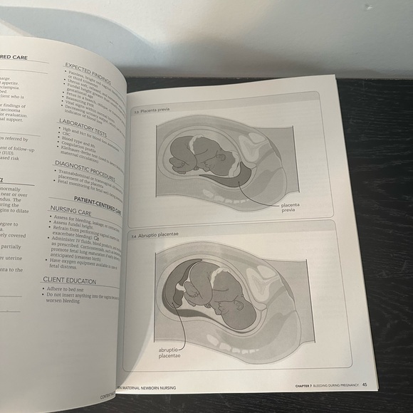 CONTENT MASTERY SERIES REVIEW MODULE RN MATERIAL NEWBORN NURSING EDITION 11.0 - Picture 7 of 8